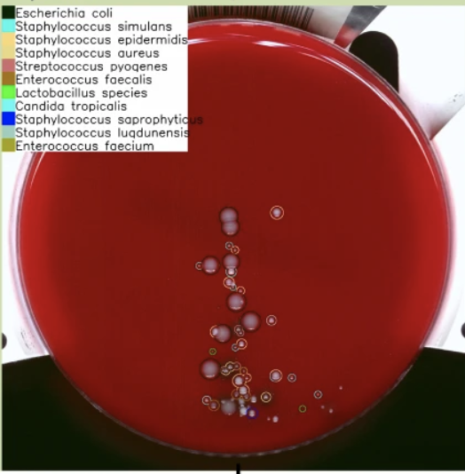 AI for Digital Microbiology